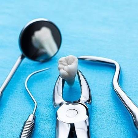 cirugia-dental-extracciones