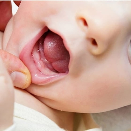odontopediatria-primeros-dientes