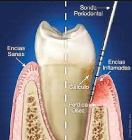 periodoncia-diagnostico